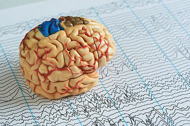 A brain model.