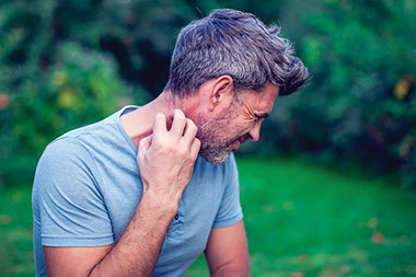 Man itching rash on neck. Man itching rash on neck.