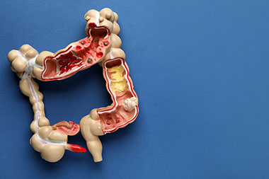 Plastic model colon showing parts of the inside of the colon.