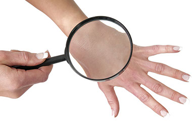 Close-up image of a person checking to see if they have any skin moles on their hand.