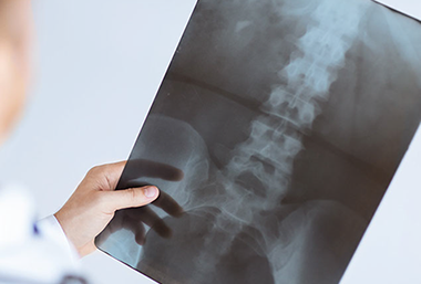 X-ray. Doctor holding an x-ray film.