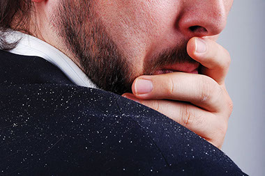 Close-up image of man's shoulder with dandruff.