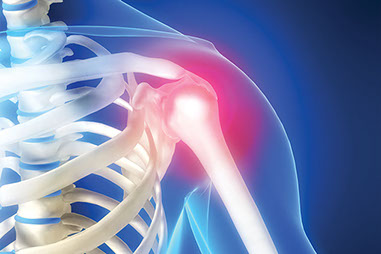 Illustration of skeleton shoulder highlighted in red for pain.