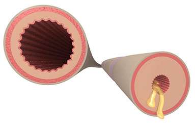 Illustration of airway.