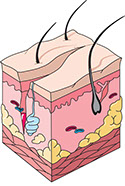 Illustration of a cut.