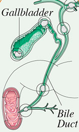 Signs and symptoms of gallstones. Illustration of gallbadder with gallstones.