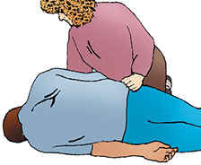 Illustration on how to place a person in the recovery position.