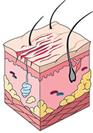 Illustration of a scrape.