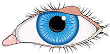 Illustration of a stye.
